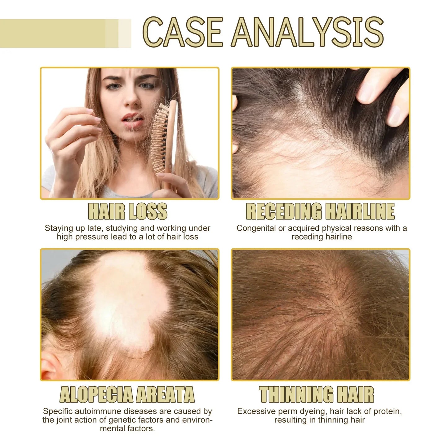 EELHOE Rosemary Oil for Hair Growth 60ml-4