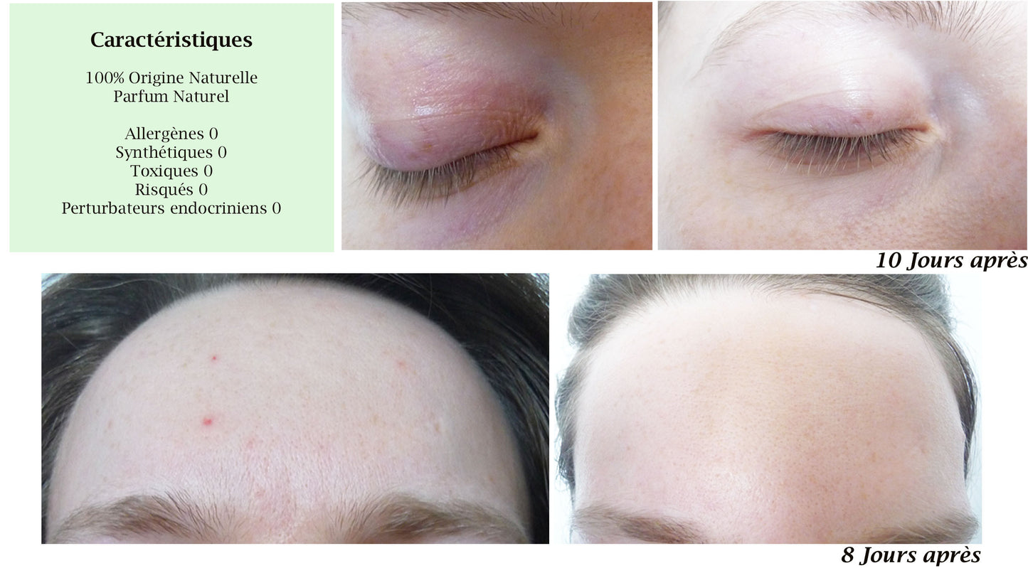 DROP - MERVEILLE DES LANDES BIO - Sensitive skin care Complete regeneration